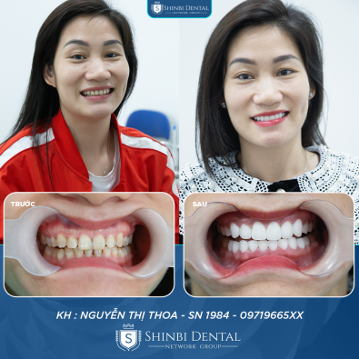 Khách hàng Nguyễn Thị Thoa